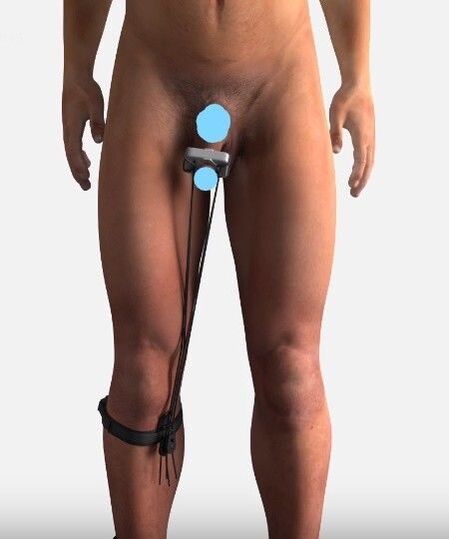 Device to improve members
